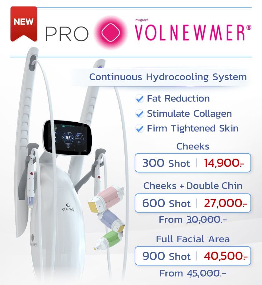 Landingpage_volnewmer_05MAY25_EN