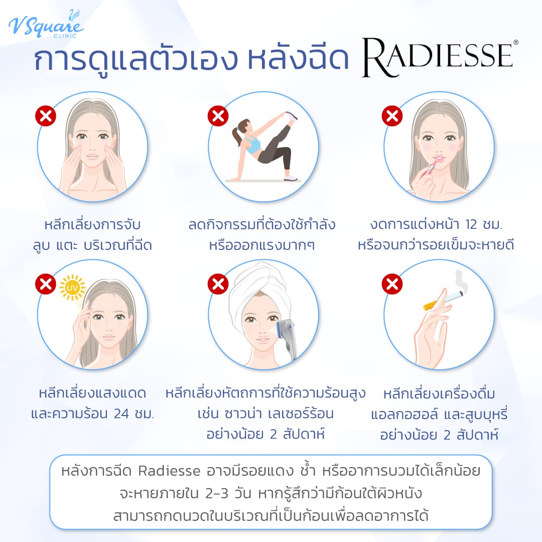 การดูแลตัวเองหลังฉีด Radiesse Plus