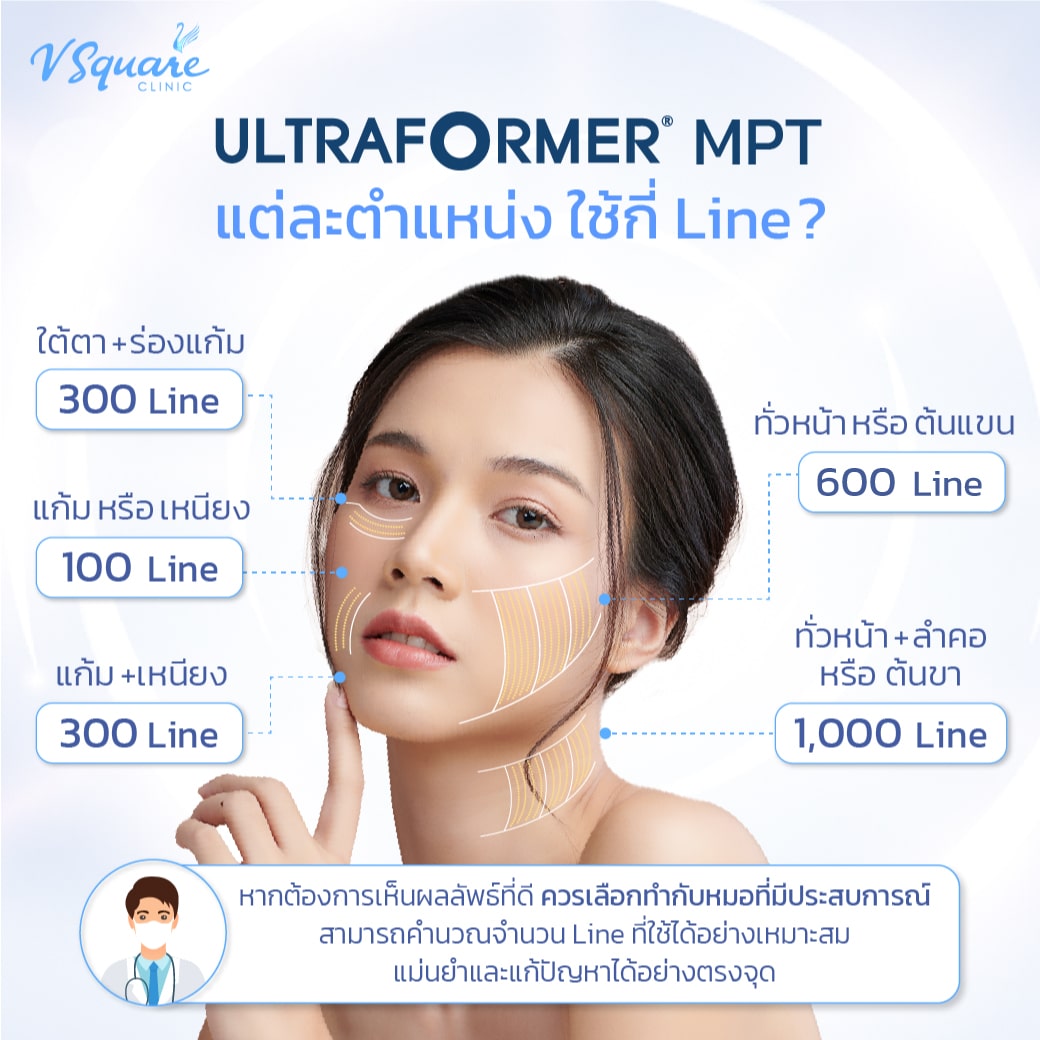 ทำ Ultraformer MPT กี่ไลน์