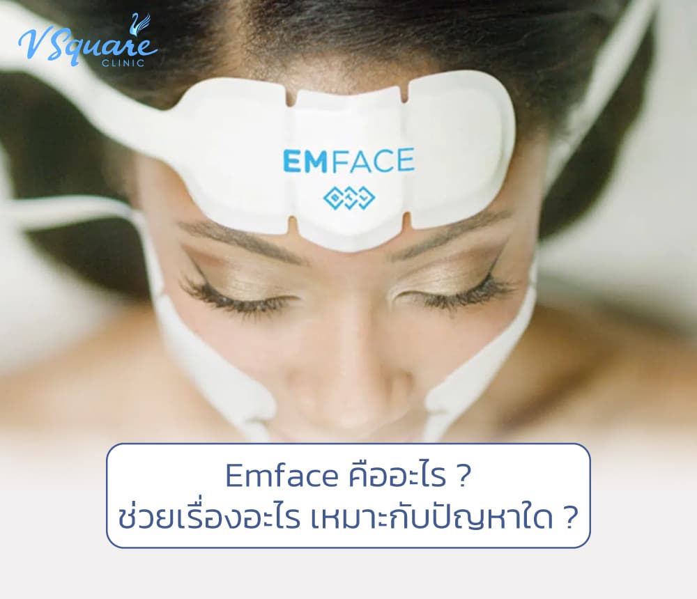 Emface