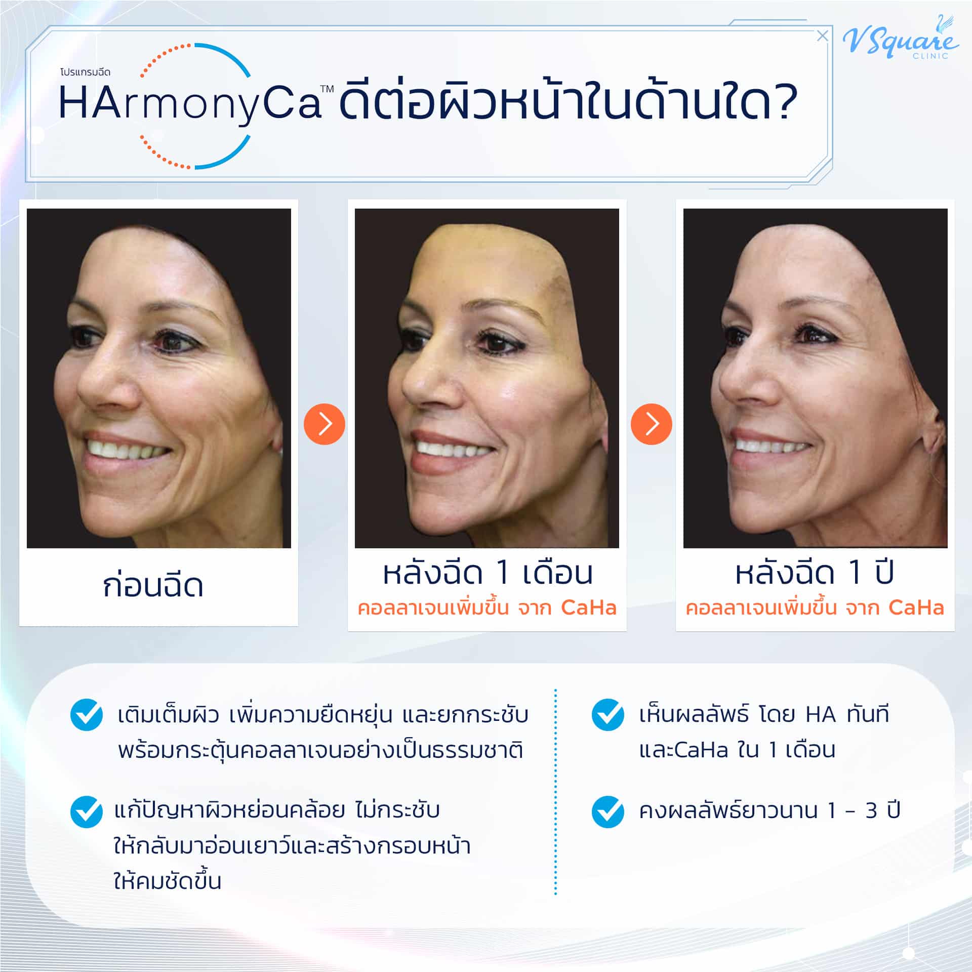 HArmonyCa ช่วยอะไร