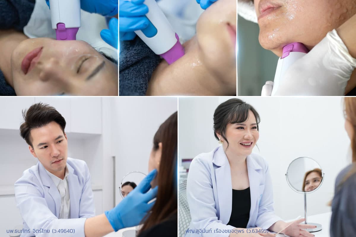 ขั้นตอนการทำ Thermage