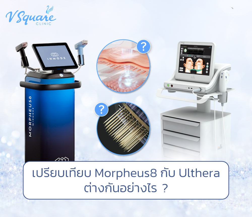 Morpheus8 กับ Ulthera ต่างกันยังไง
