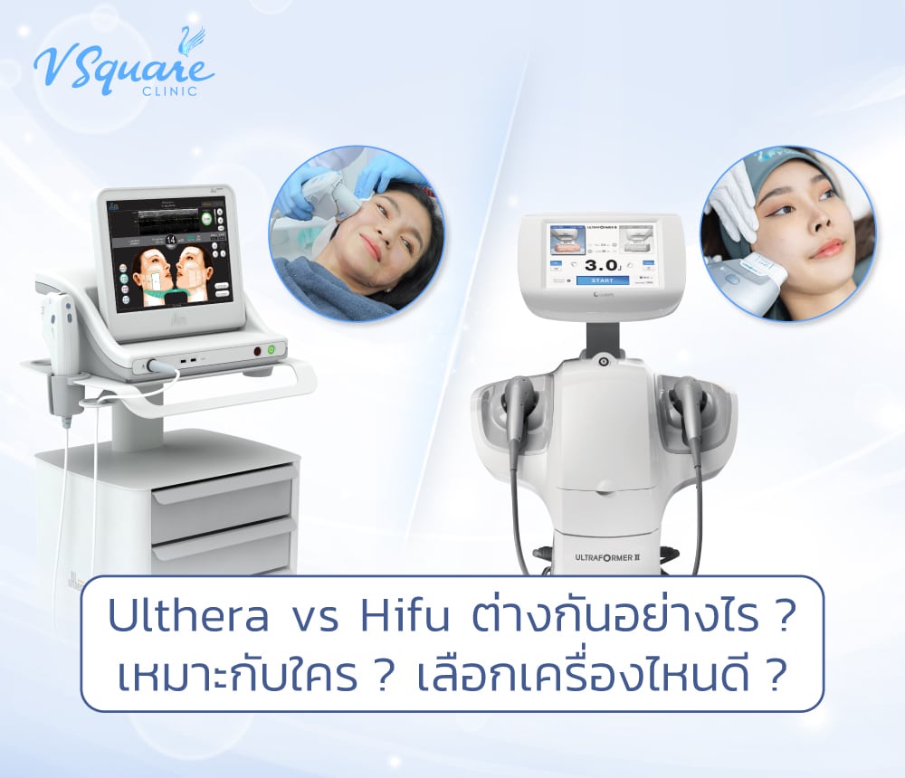Ulthera vs Hifu