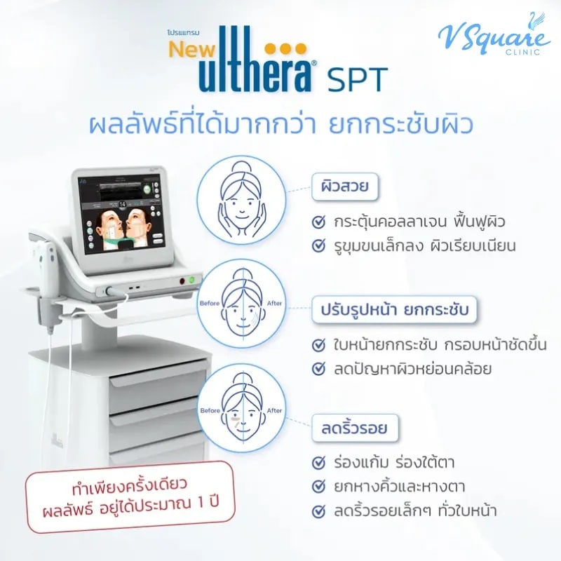Ulthera ช่วยเรื่องอะไร