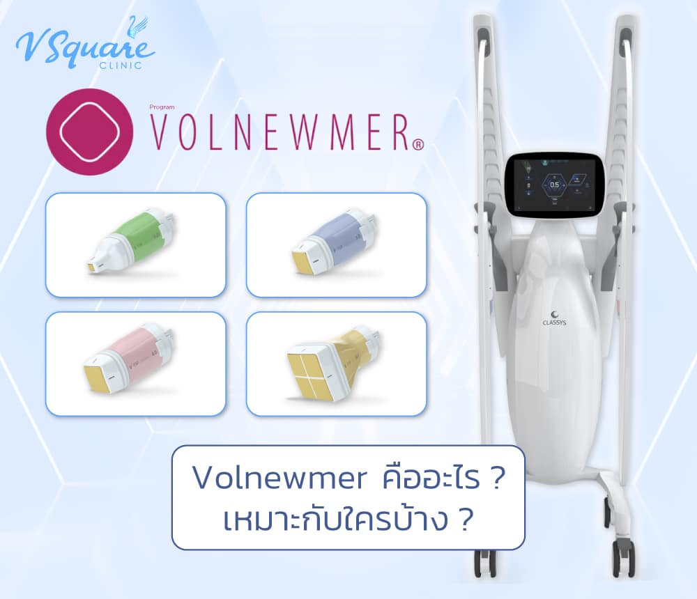Volnewmer
