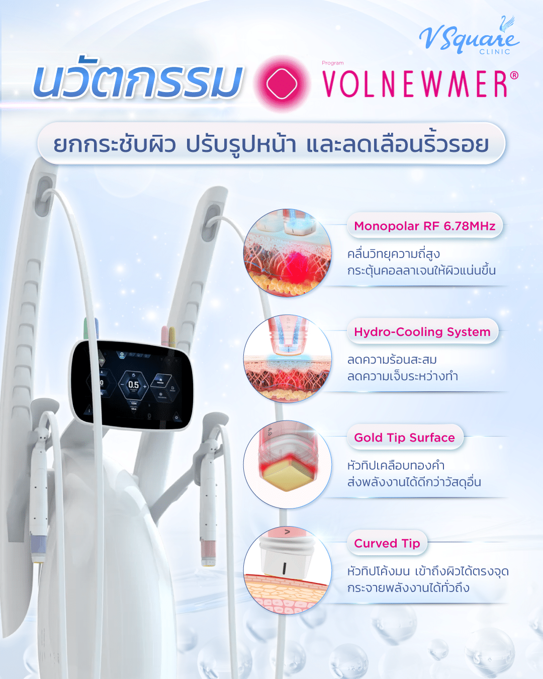 จุดเด่นของ Volnewmer
