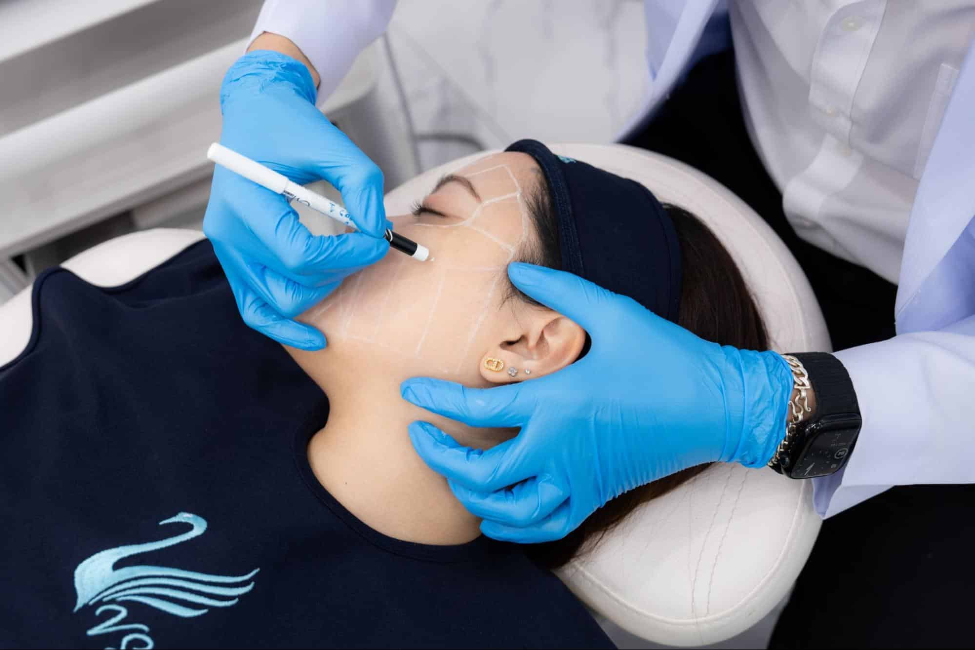 ทำ Ulthera Prime ราคาคุ้มค่า ที่ V Square Clinic