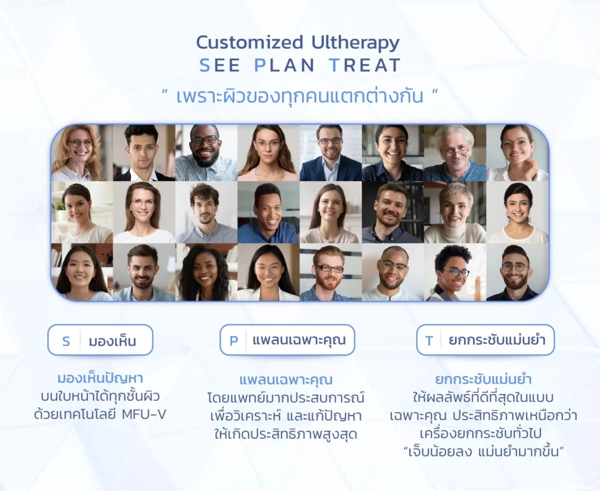 เทคโนโลยี Ulthera SPT