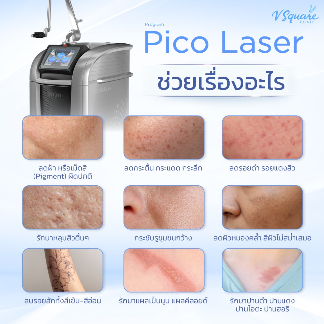 Pico Laser กระตุ้นคอลลาเจน