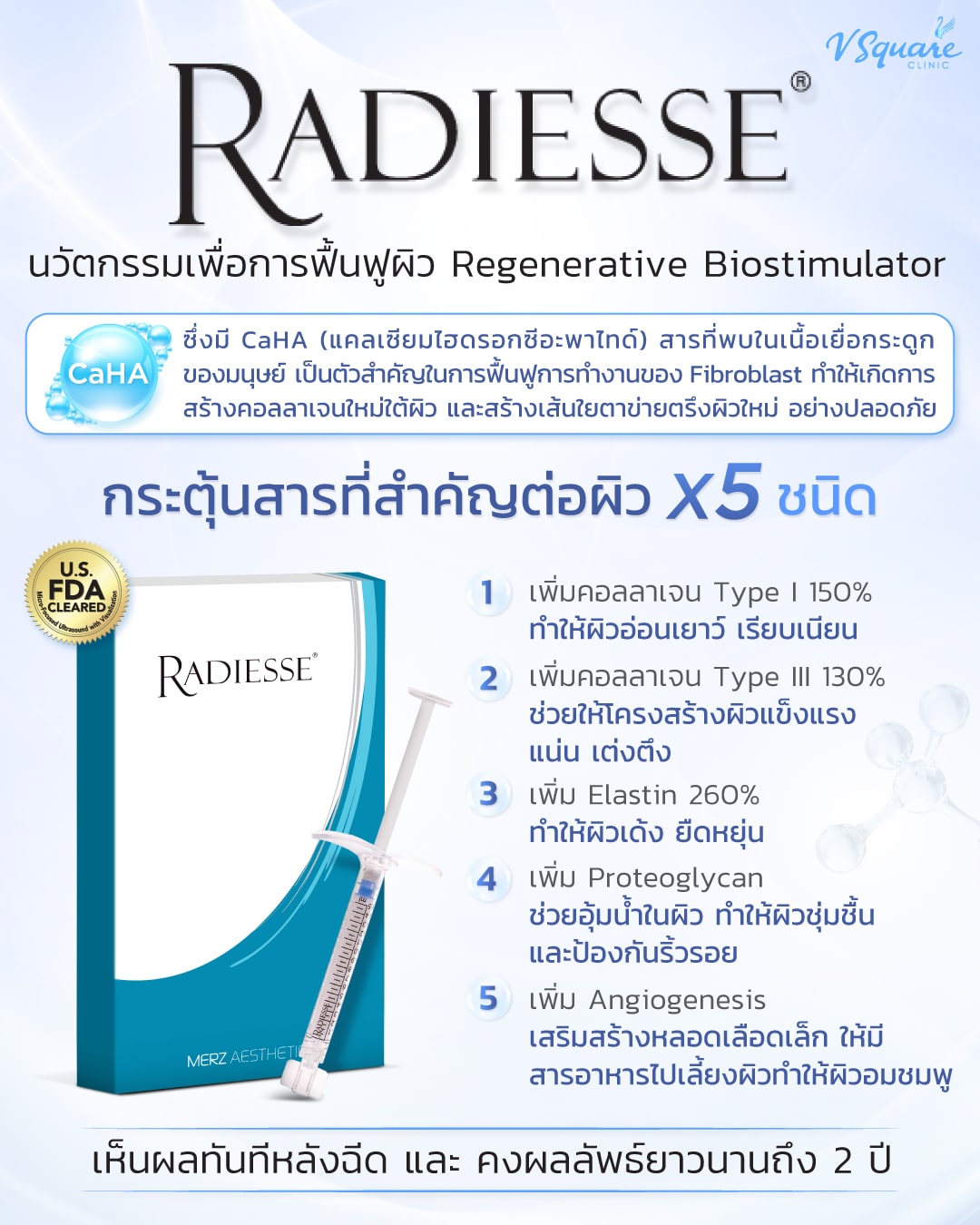 Radiesse กระตุ้นคอลลาเจน