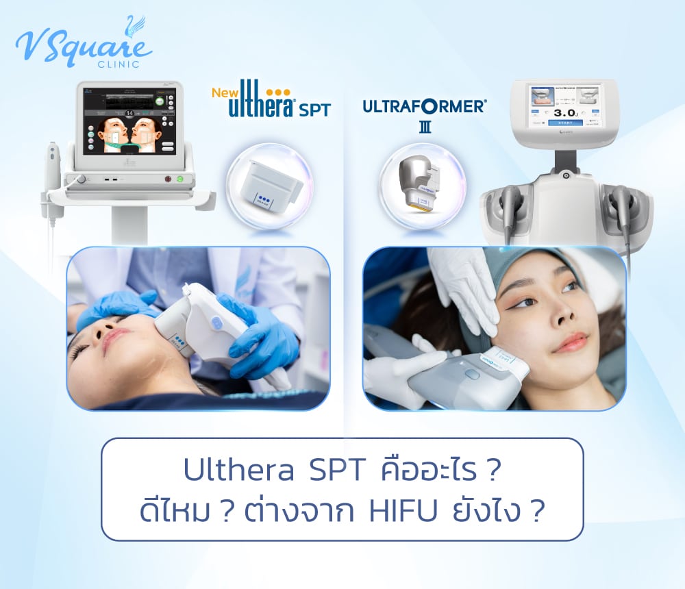 Ulthera SPT
