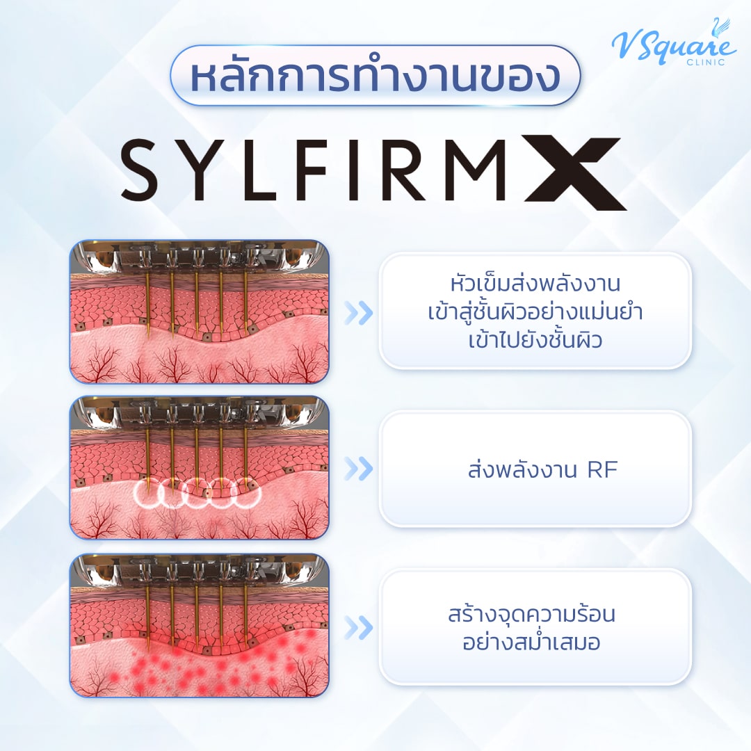 Sylfirm X กระตุ้นคอลลาเจน