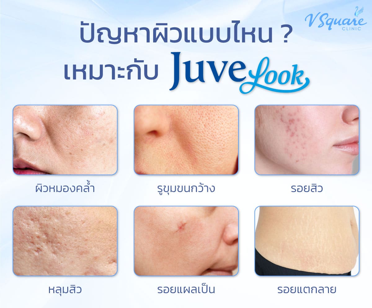 juvelook กระตุ้นคอลลาเจน