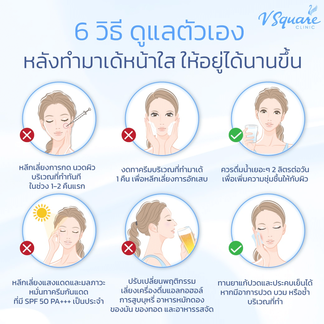 หลังฉีดมาเด้คอลลาเจน