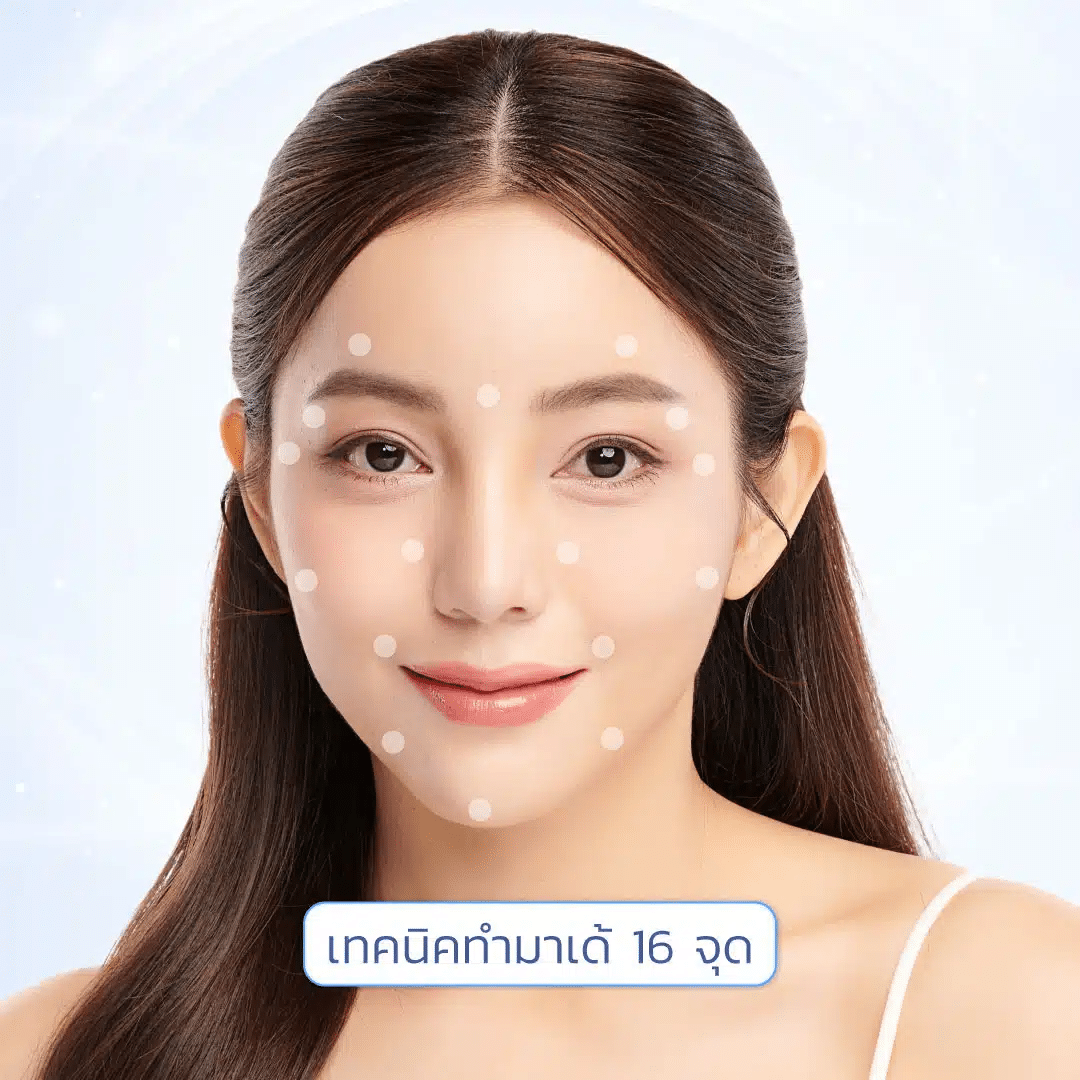 เทคนิคฉีดมาเด้คอลลาเจน 16 จุด