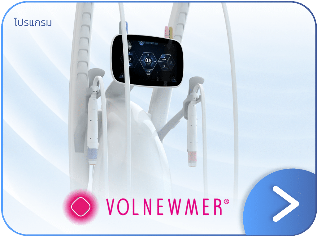 Volnewmer