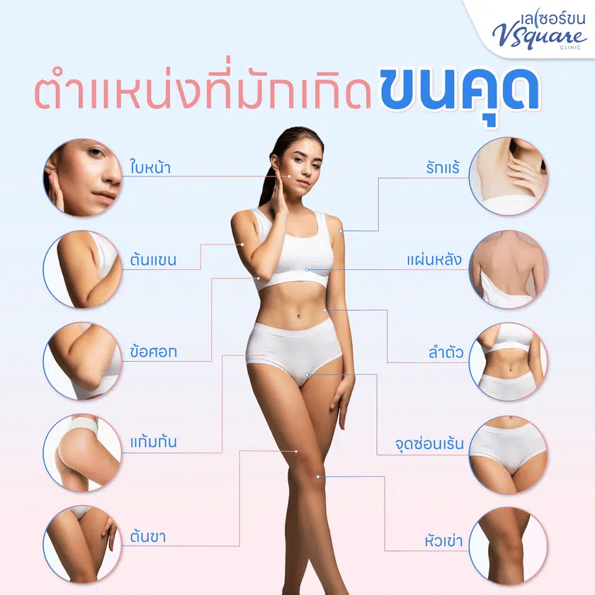 บริเวณเกิดขนคุด