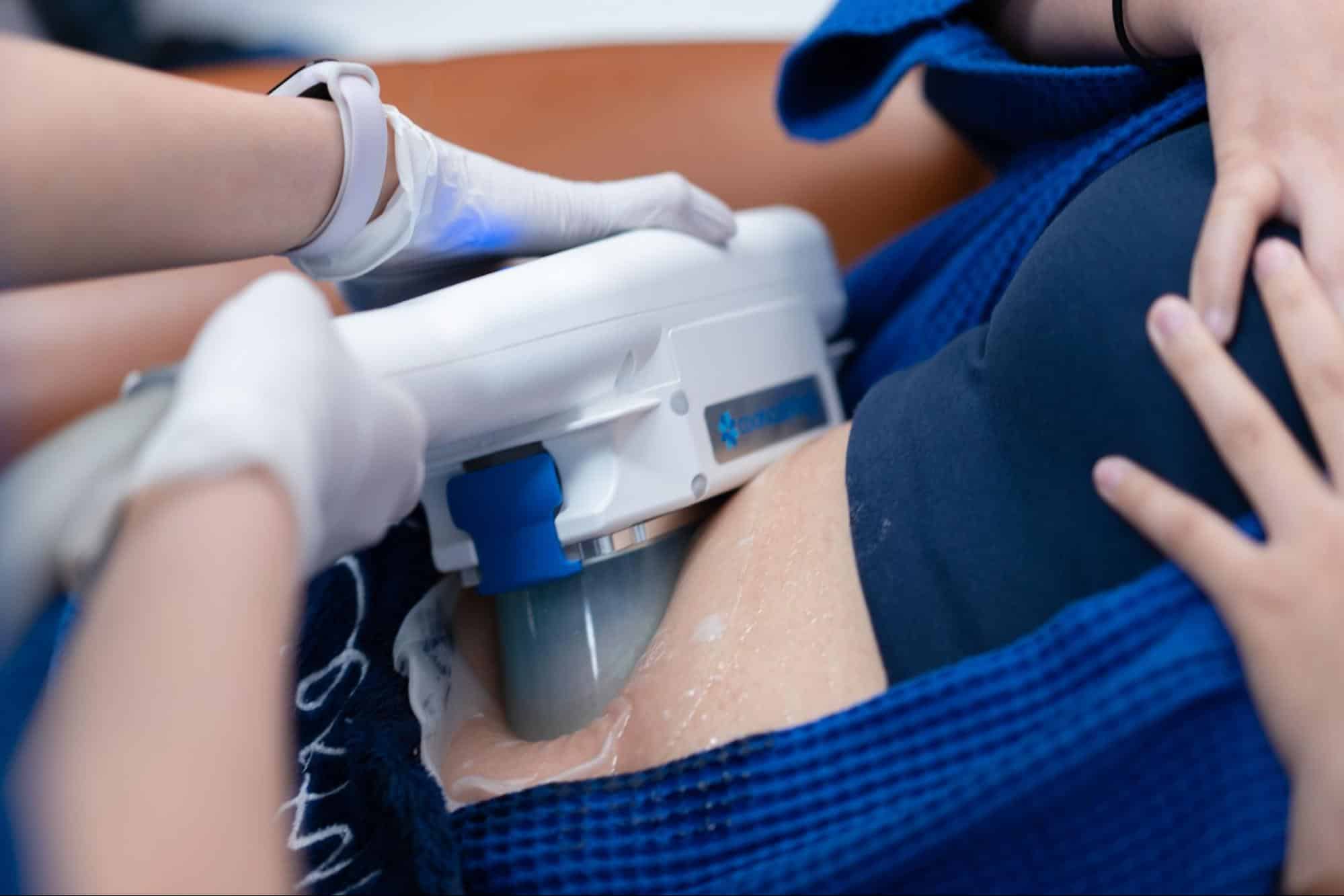 CoolSculpting คืออะไร