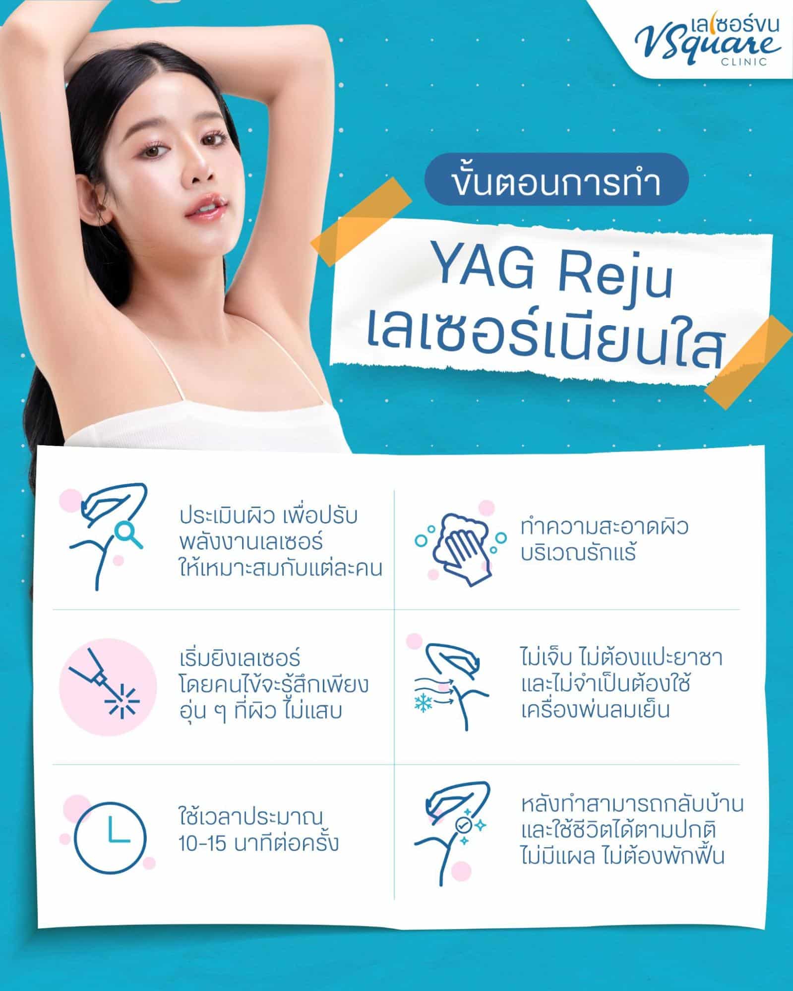 YAG Reju ขั้นตอน