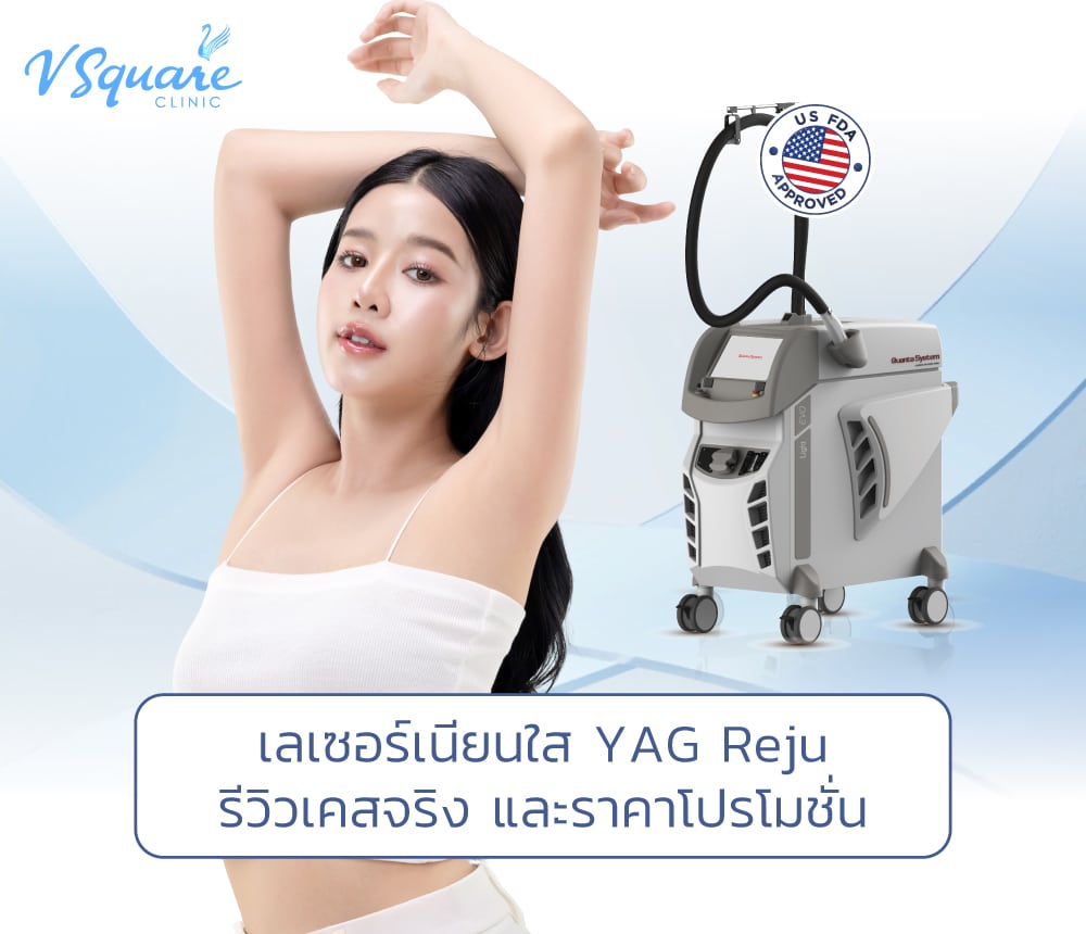 YAG Reju