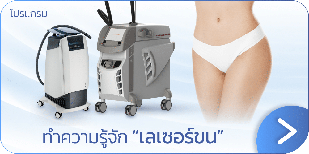 แบนเนอร์เลเซอร์ขน