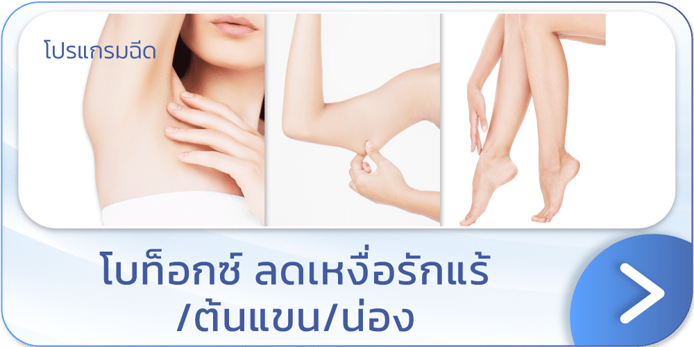 แบนเนอร์โบท็อกรักแร้ ลดเหงื่อ