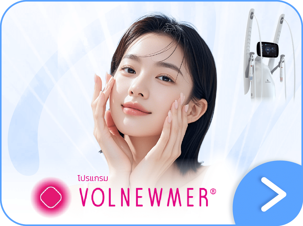 Volnewmer