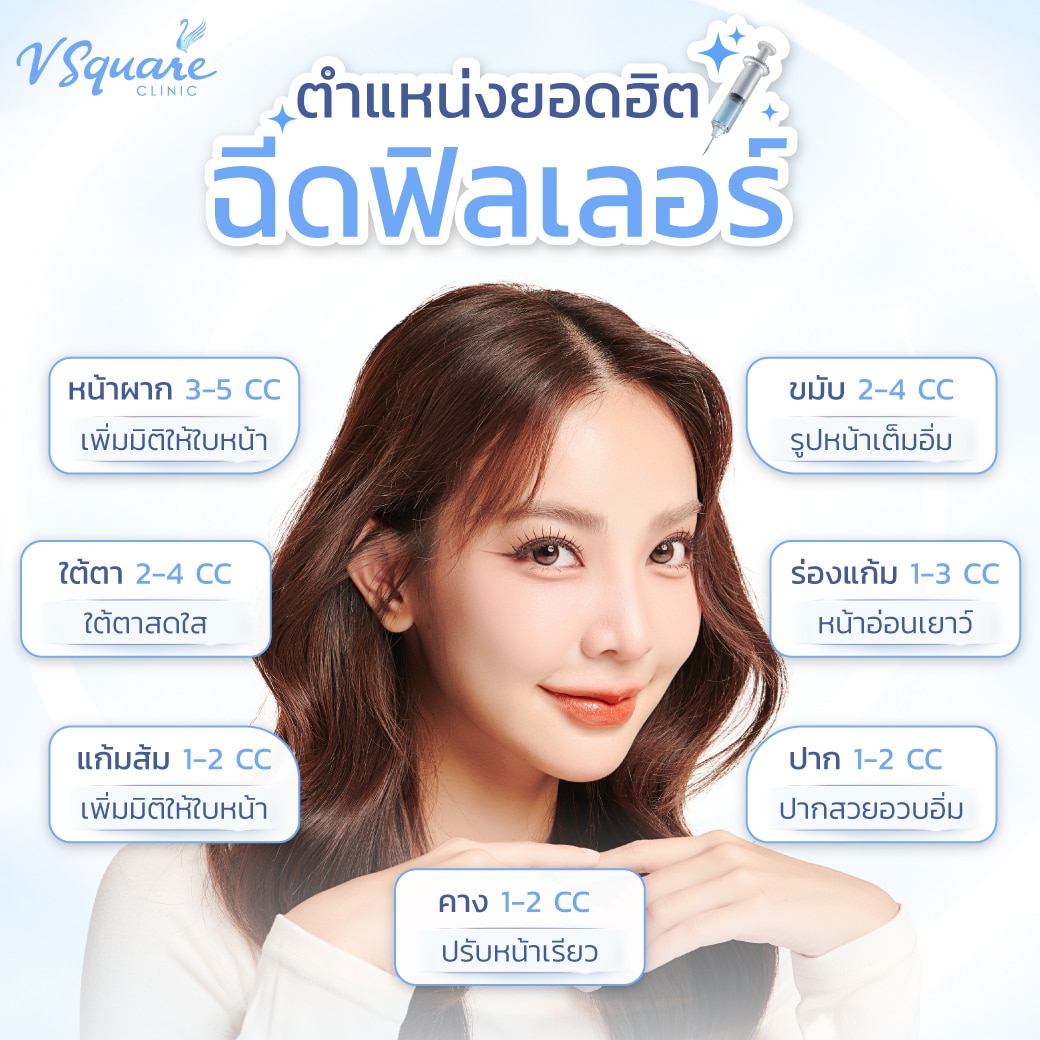 ฉีดฟิลเลอร์ตำแหน่งไหนได้บ้าง