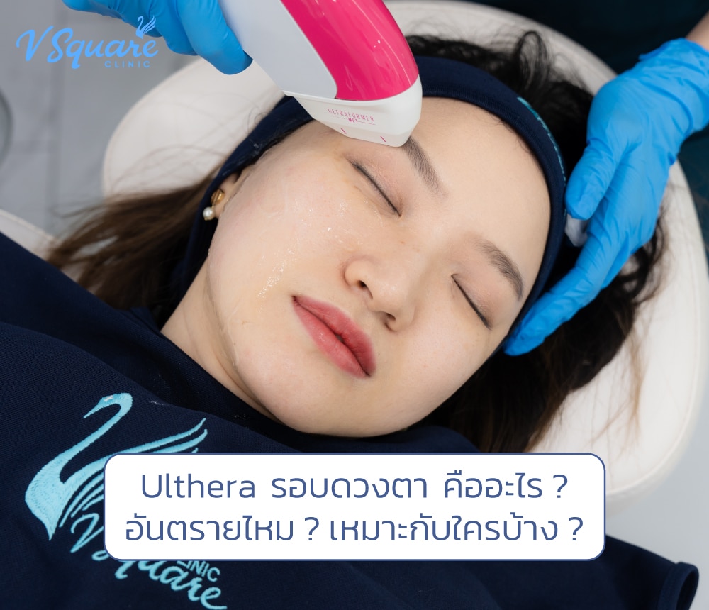 Ulthera รอบดวงตา