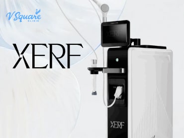 XERF 370x277