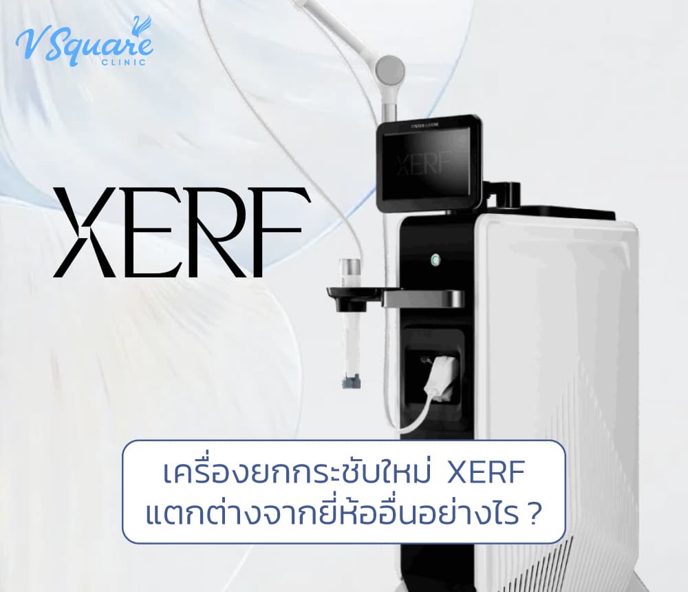 XERF