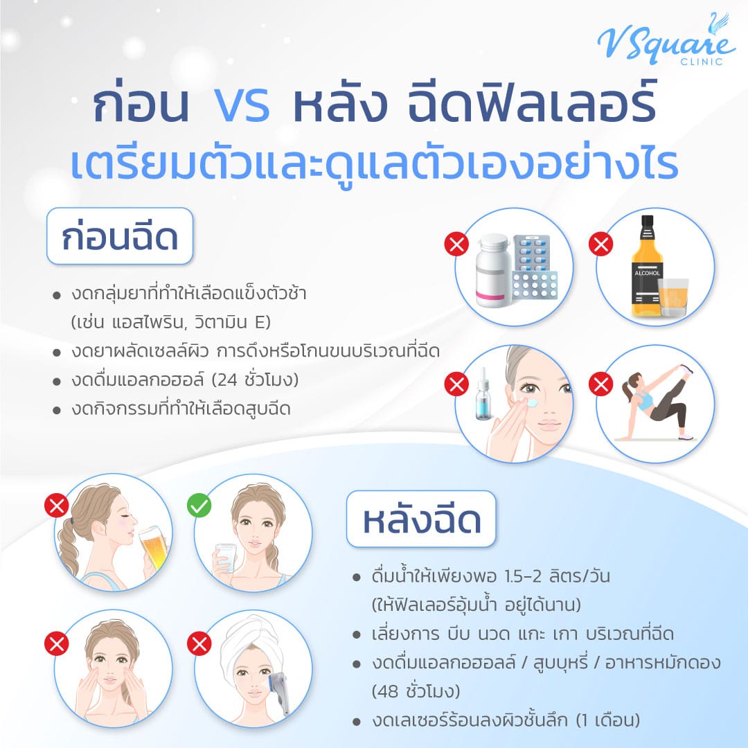 ก่อนหลังฉีดฟิลเลอร์ ดูแลอย่างไร
