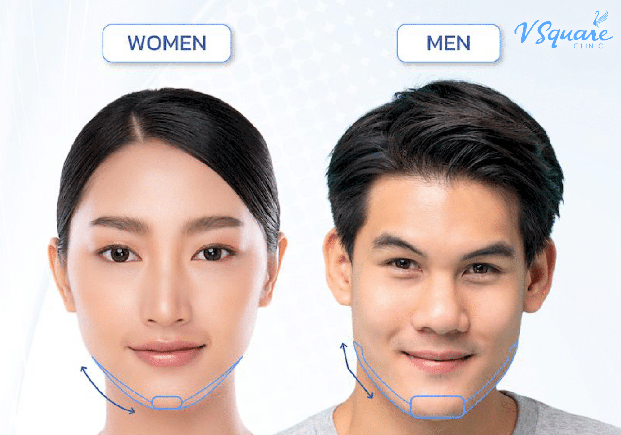 ฉีดฟิลเลอร์กรอบหน้าผู้ชาย vs ผู้หญิง