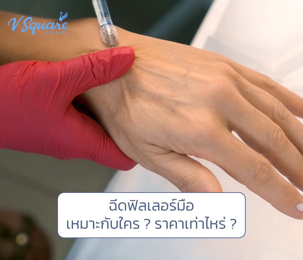 ฉีดฟิลเลอร์มือ