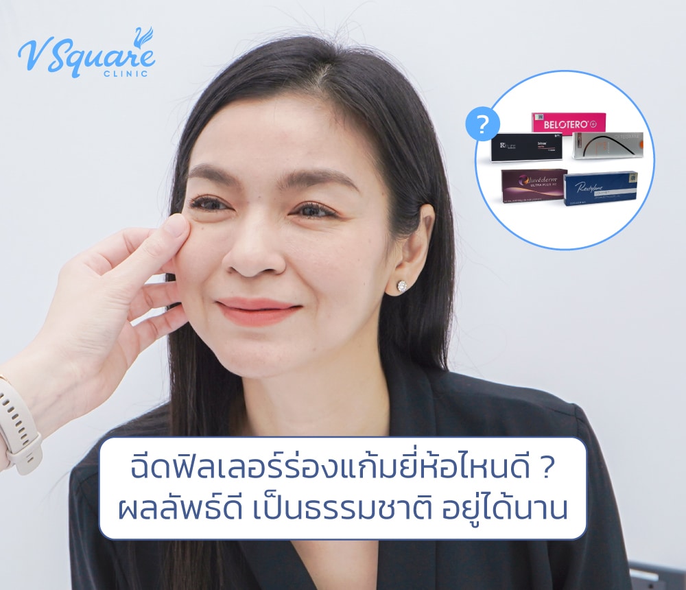 ฉีดฟิลเลอร์ร่องแก้มยี่ห้อไหนดี