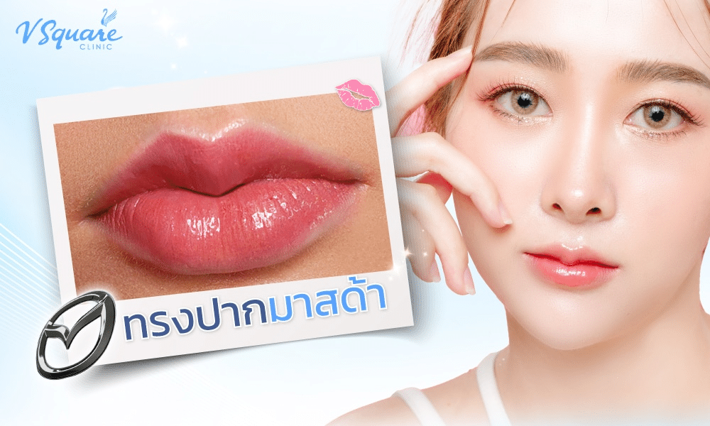 ทรงปากกระจับมาสด้า
