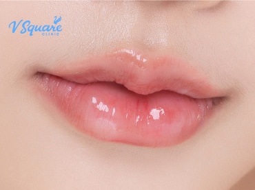 ทำปากกระจับ ราคา 370x277