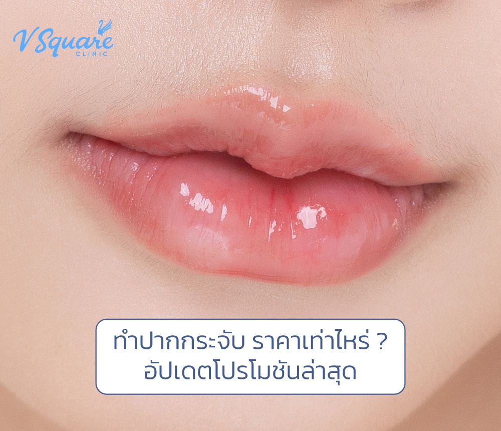 ทำปากกระจับ ราคา