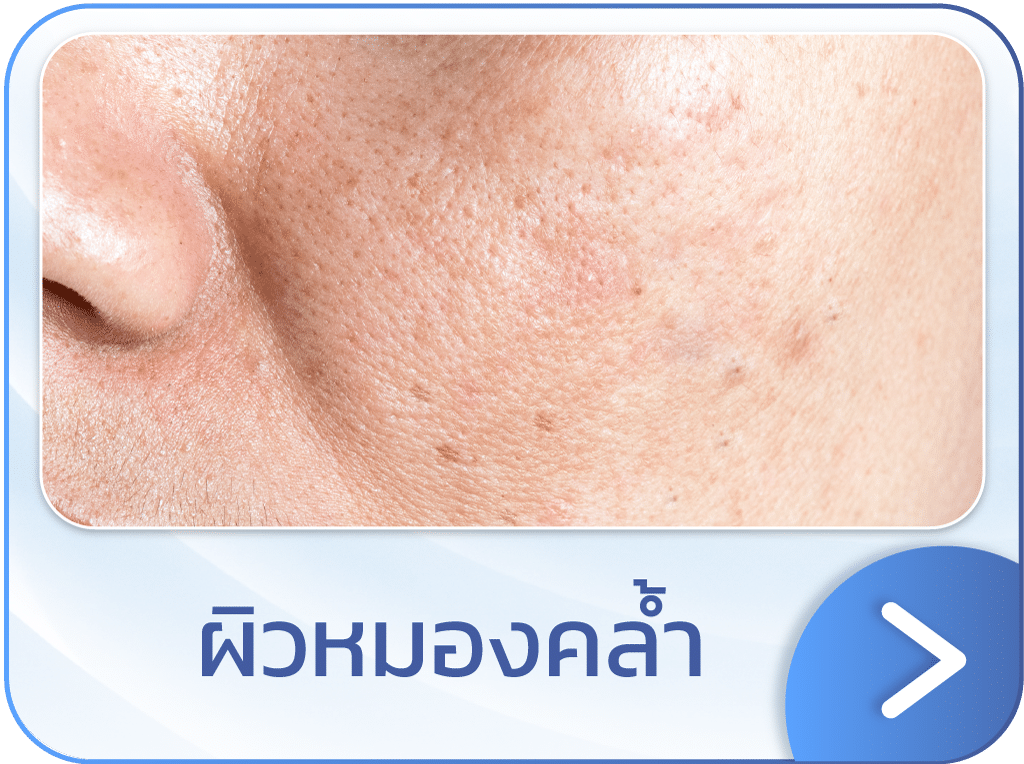 Discovery Pico ผิวหมองคล้ำ