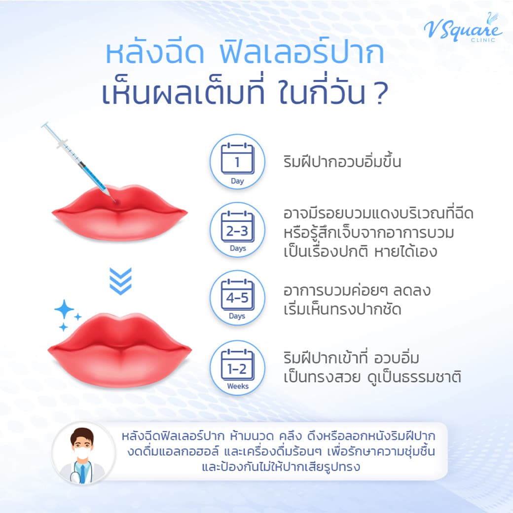 ฟิลเลอร์ปากเห็นผล