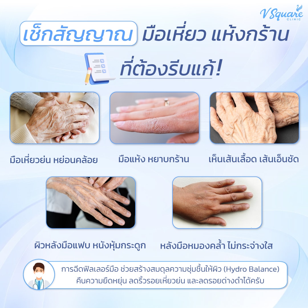 ฟิลเลอร์มือ แก้มือเหี่ยว