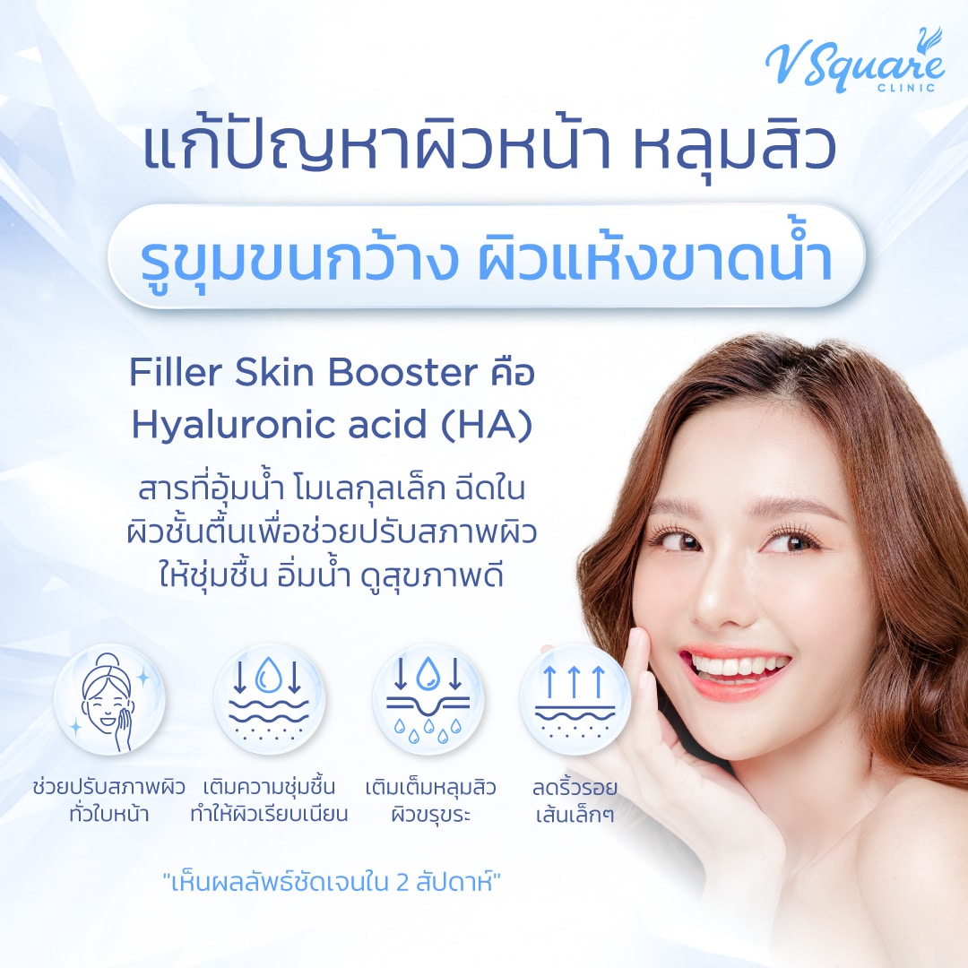 ฟิลเลอร์หลุมสิว skinbooster
