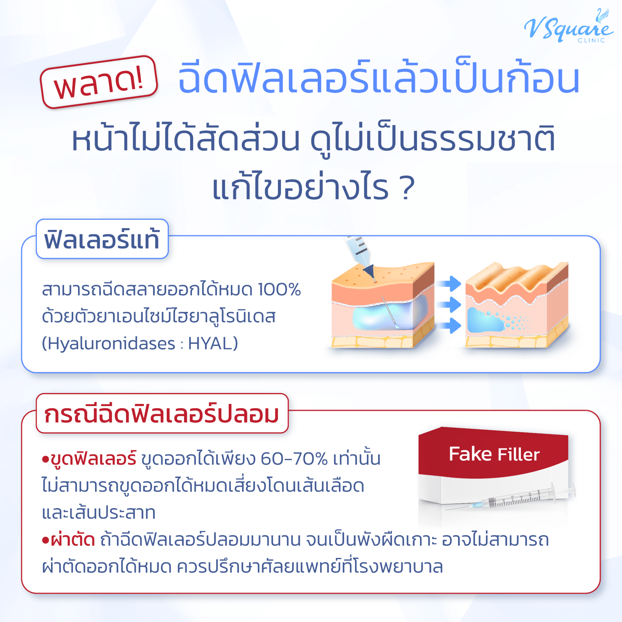 ฟิลเลอร์เน่า แก้ยังไง