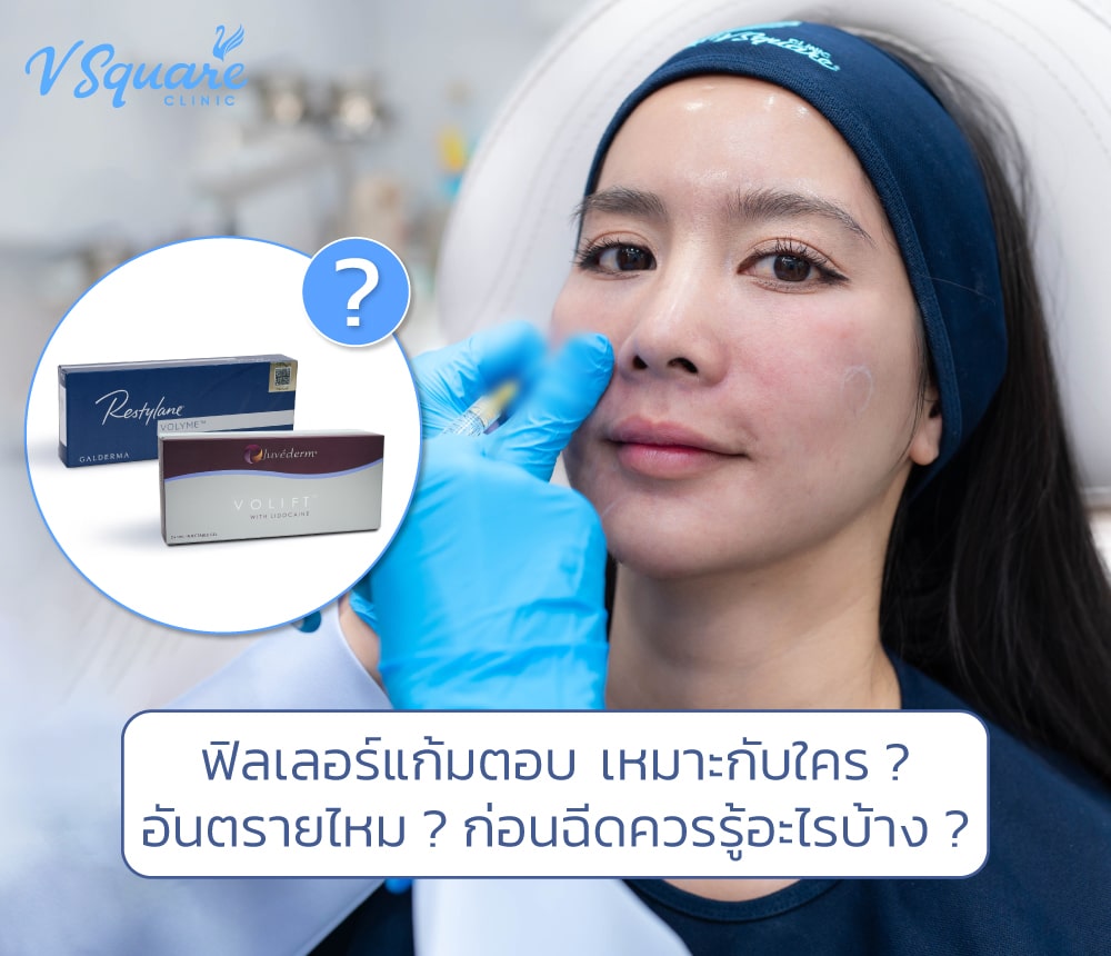 ฟิลเลอร์แก้มตอบ