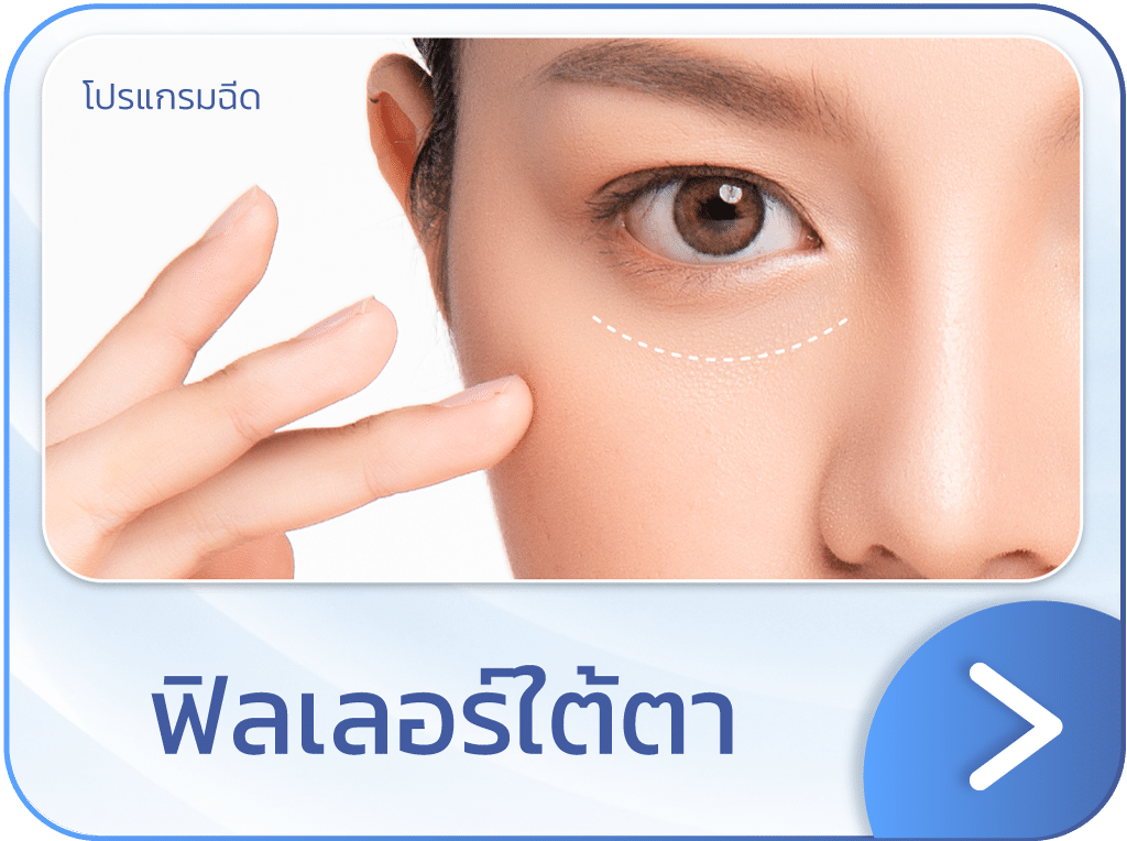 ฟิลเลอร์ใต้ตา