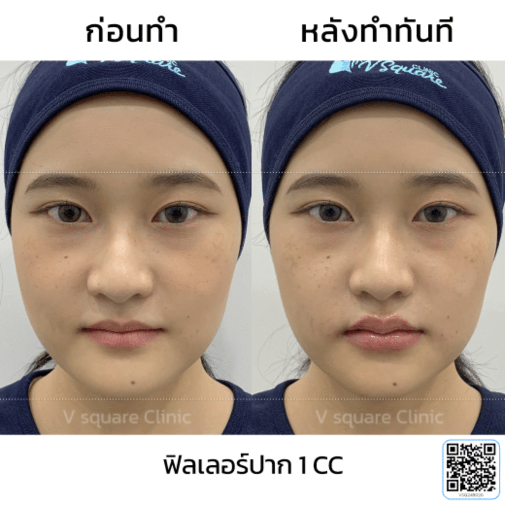 รีวิวปากกระจับ_พัสสา Influencer
