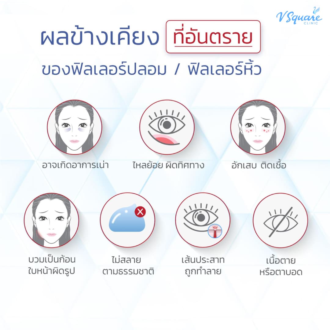 อาการฟิลเลอร์เน่า