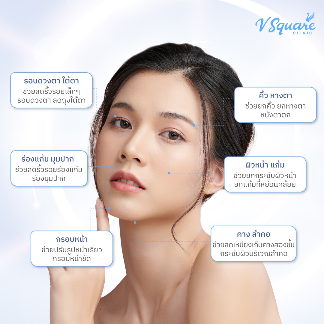 Hifu-ทำตำแหน่งไหนได้บ้าง1_1