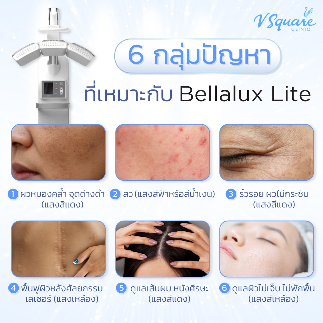 ปัญหาที่เหมาะกับ Bellalux lite
